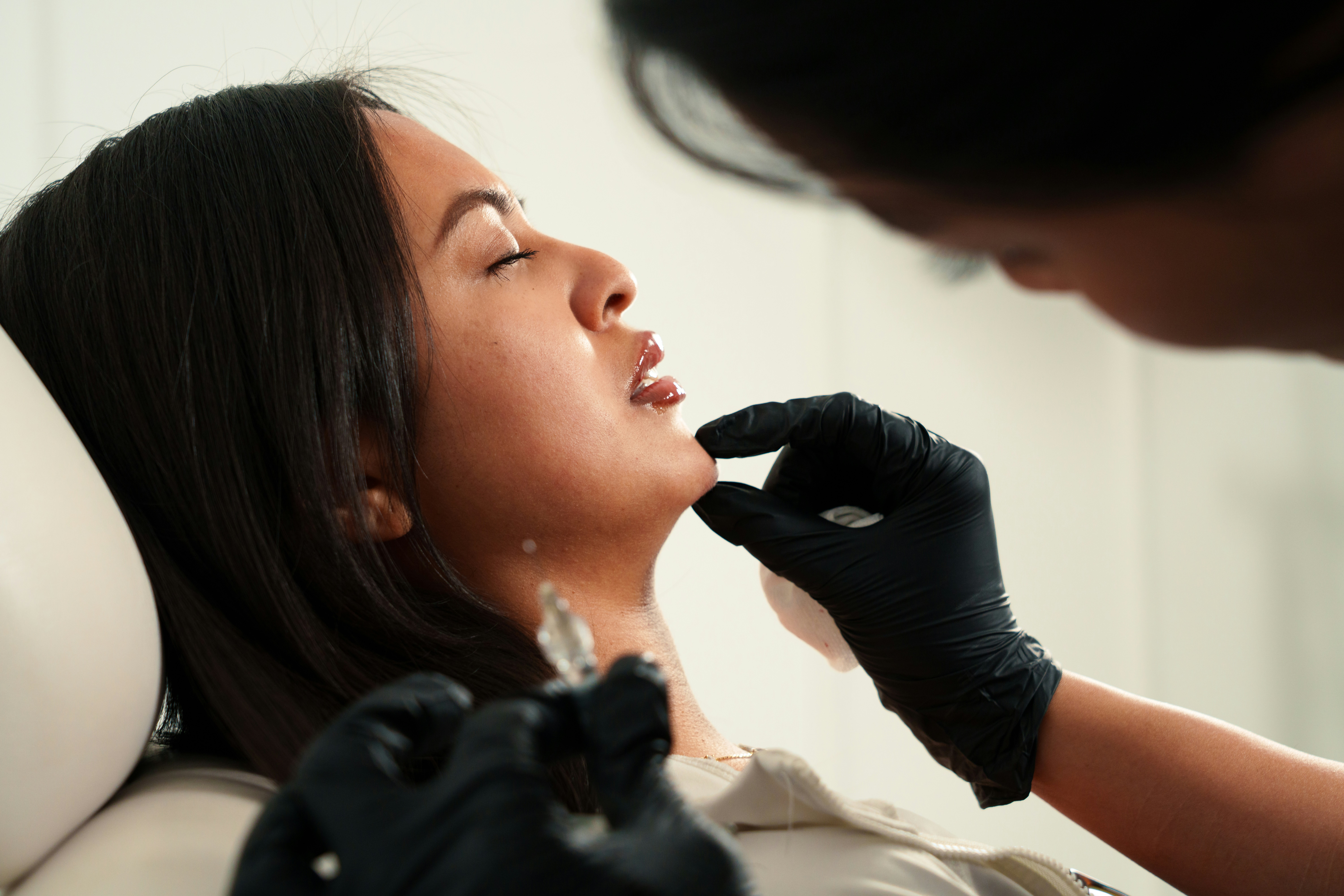 A nurse injector in black gloves treating a client’s chin while she reclines