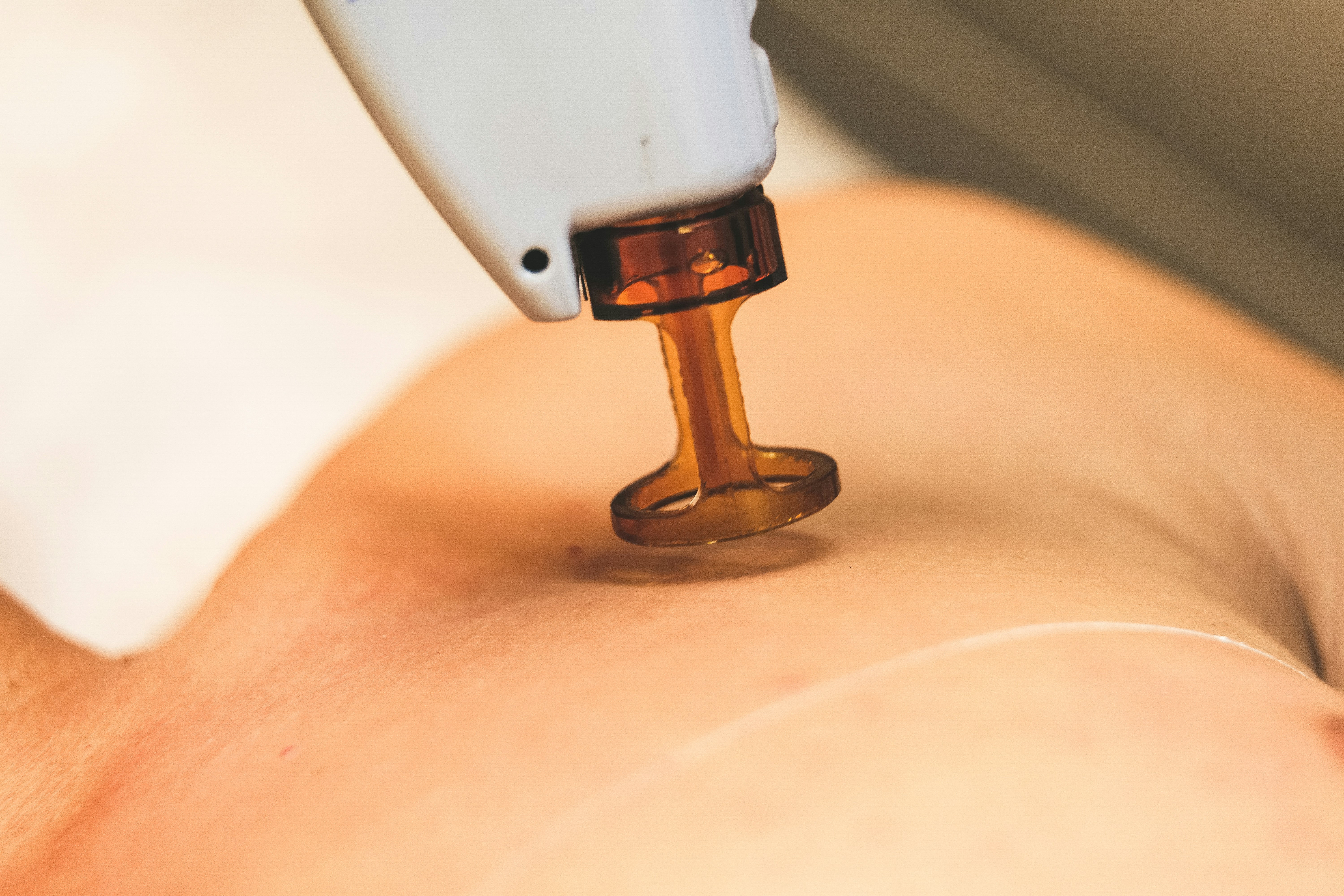A laser handpiece pressed against a client’s skin