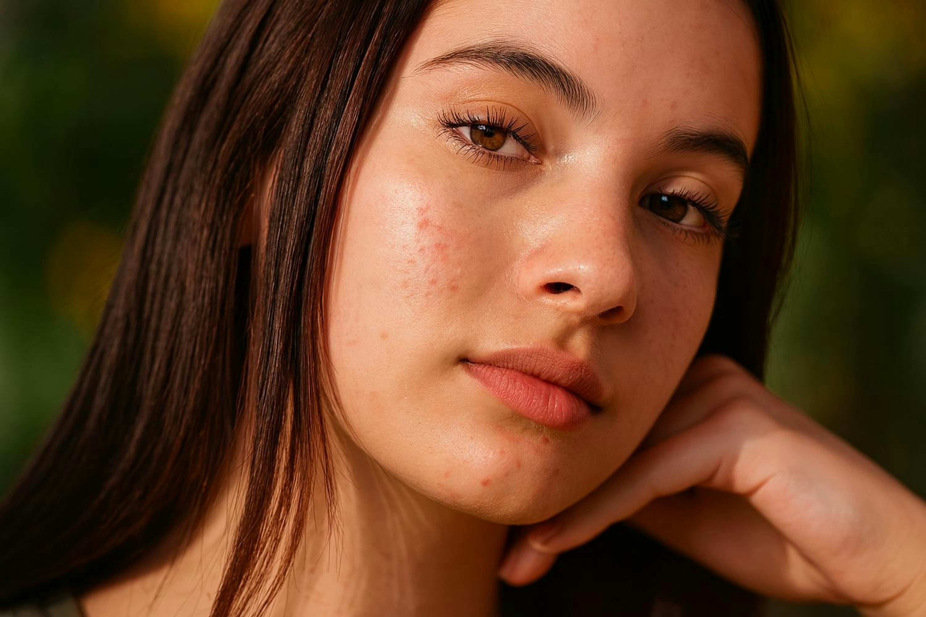 A young woman with visible skin texture resting her chin on her hand