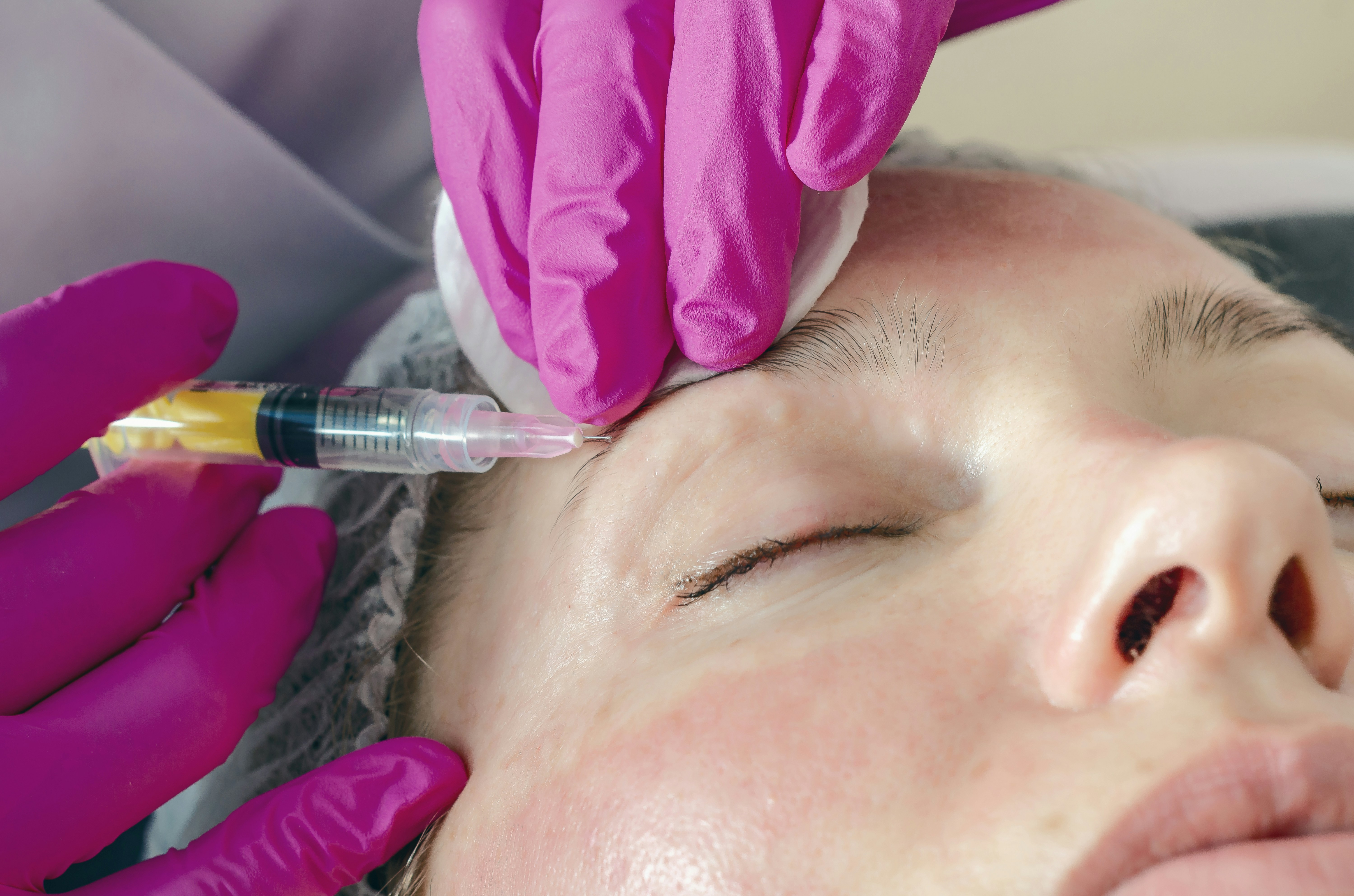 A provider in pink gloves injecting a small dose into a client’s forehead